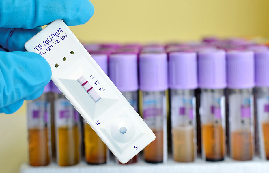 Biopharmaceutical Company Official Website Development Case Study: From Internally Built Site to Branded Official Website